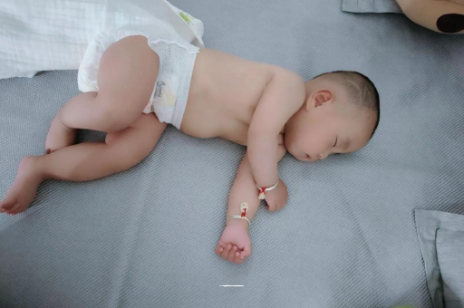 邵阳宝宝头上长痱子